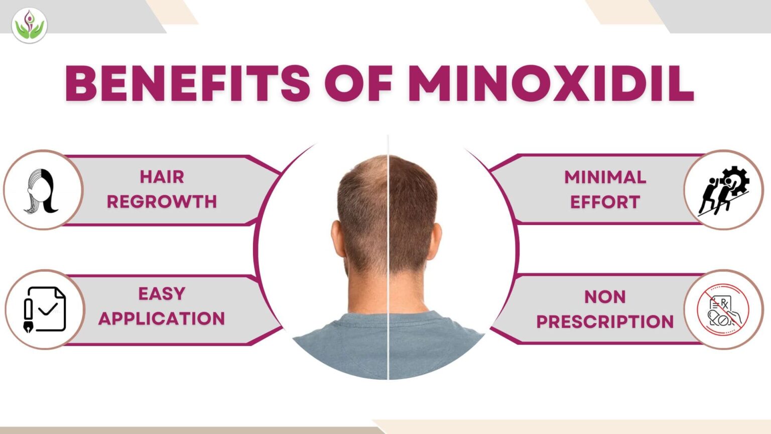 Minoxidil Side Effects For Men Women A Comprehensive Guide Dr