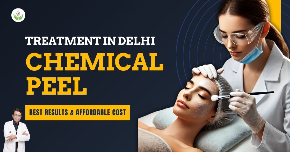 Chemical Peel Treatment in Delhi